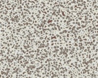 бактерія мікроскоп.jpg