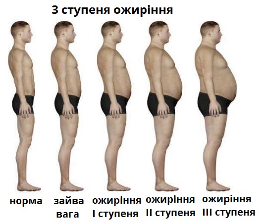 ожиріння.jpg