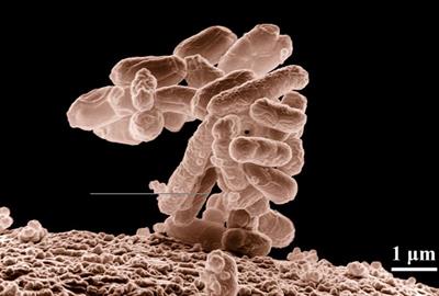 Бактерія2-кишкова паличка.jpg