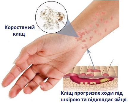 коростяний_кліщ.jpg