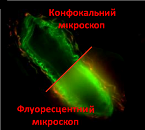 флуоресцентний мікроскоп.png