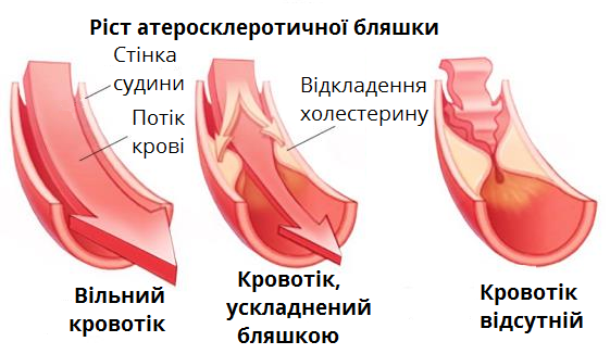 бляшка.png